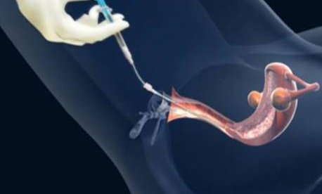 北医三院特需试管要等多久？附北京三代试管医院优秀介绍！