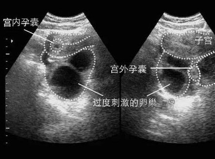 做备孕检查，发现排卵异常该怎么办？