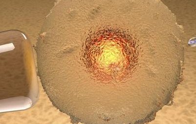 饭后半小时内就水服用，溴隐亭服用方法介绍